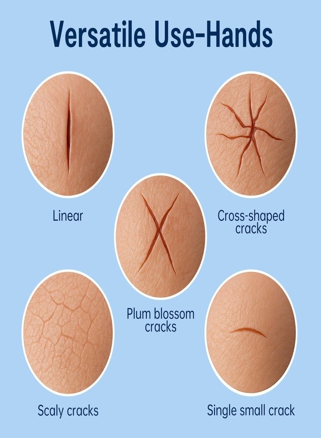 PUREEASE Moisturizing Crack Patches –For Linear, Single Small Crack,For Dry,Cracked Hands,Elbows, Chapped Knees Skin Relief, Hydrating Care – Flexible & Breathable, 10 Patches - Image 5